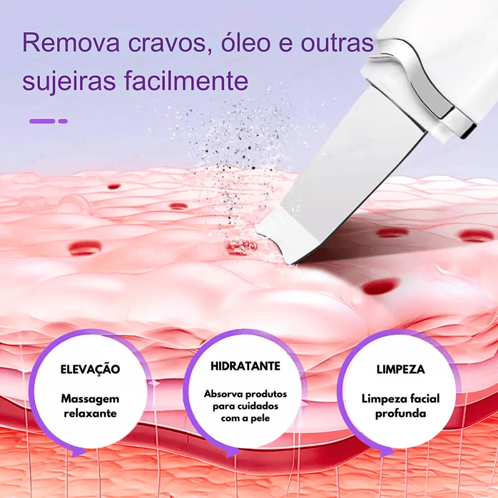 Caneta Peeling Ultrassônico Ionização Portátil Anti EL-1931